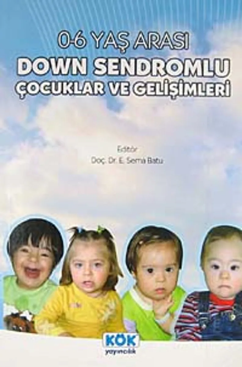 Down Sendromlu Çocuklar ve Gelişimleri 0-6 Yaş Arası