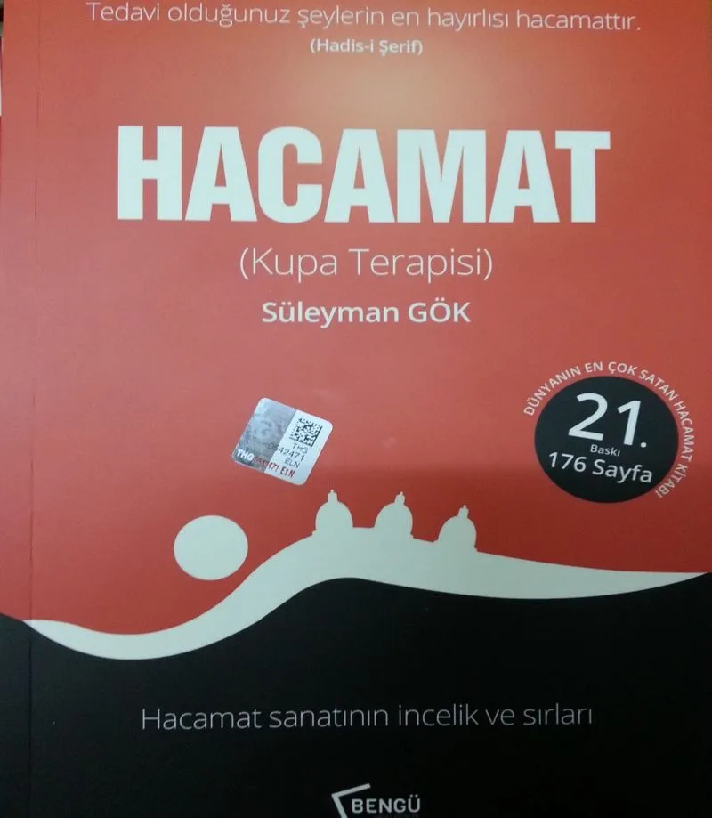 Hacamat (Kupa Terapisi)