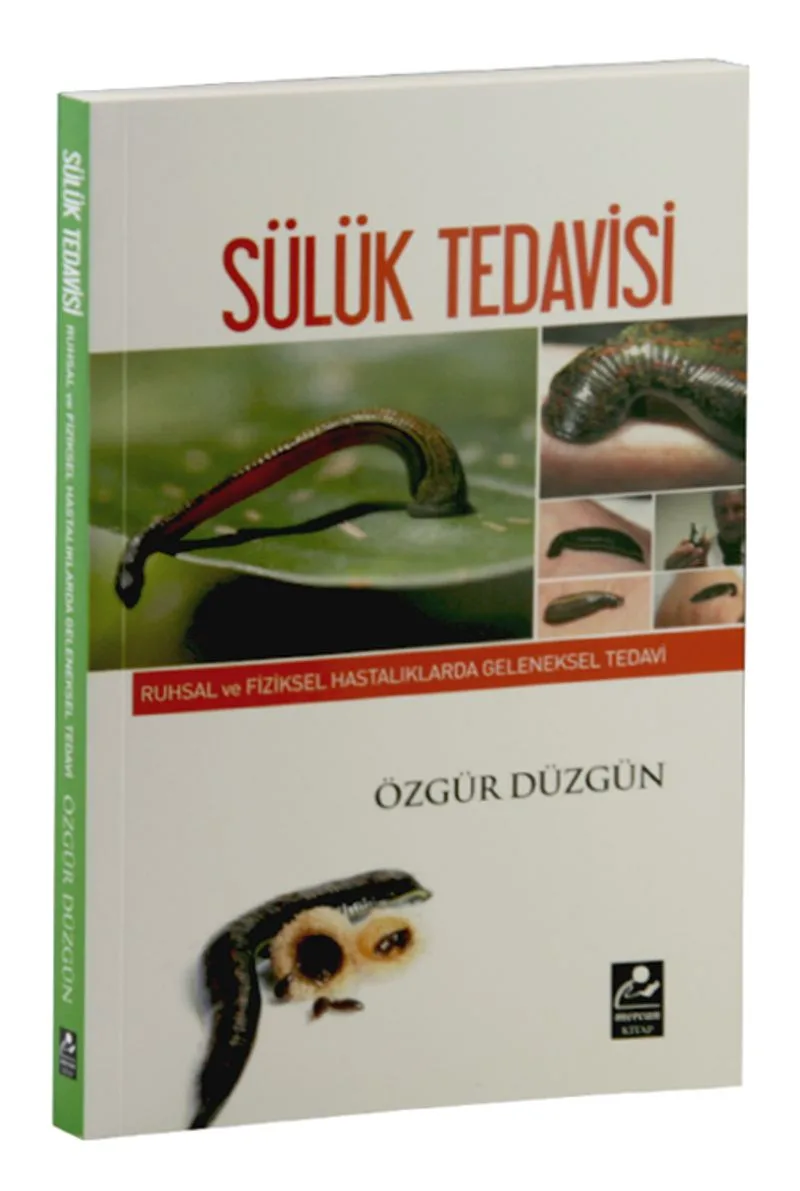 Sülük Tedavisi Ruhsal ve Fiziksel Hastalıklarda Geleneksel Tedavi